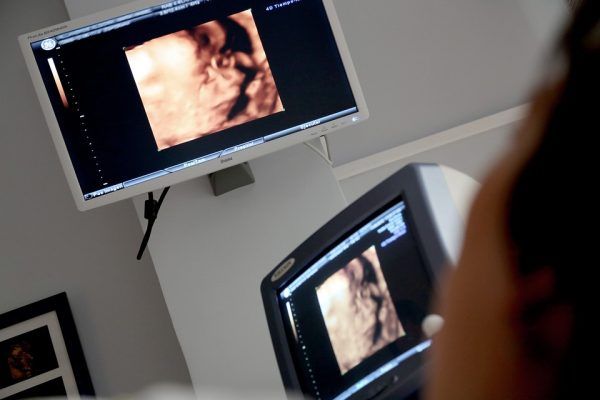 На покупку УЗИ-аппарата и маммографа для Октябрьской райбольницы в Приморье выделили более 20 млн рублей