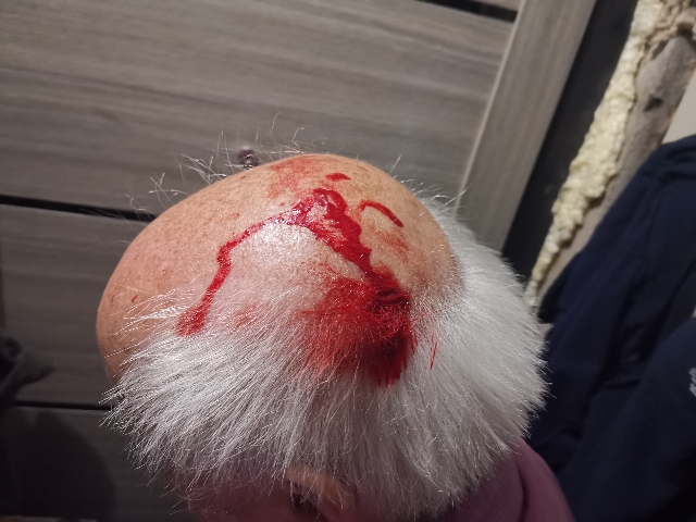 Вся голова в крови: агрессивный ворон напал на мужчину во Владивостоке — фото