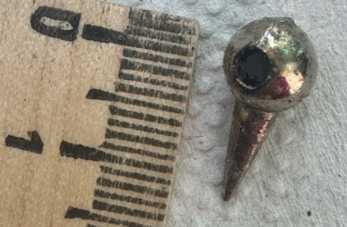 Во Владивостоке спасли 10-летнего мальчика, проглотившего бусину с шипом