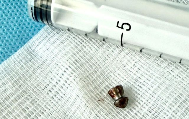 В Приморье 12-летний мальчик выстрелил себе из винтовки в лицо